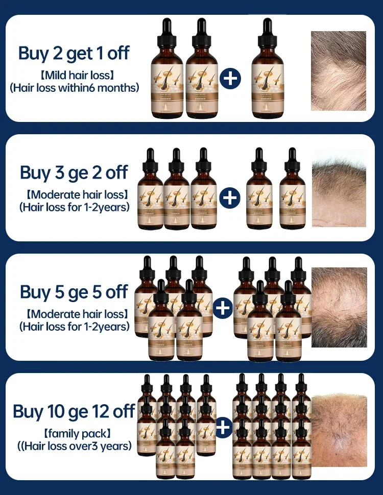 Unisex Saç Büyüme Yağı Saç Dökülmesi Tedavisi Hızlı Saç Büyüme Etkili Kellik Onarım Kalıtsal Doğum Sonrası Kaybı Görüntü 4