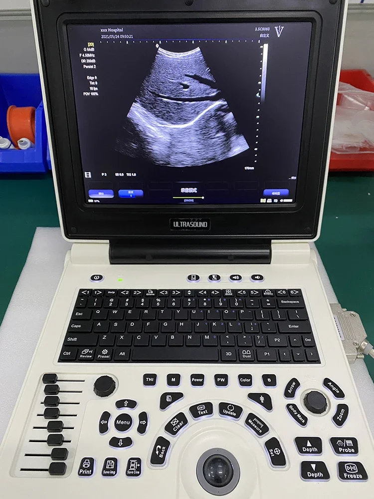 Taşınabilir ultrason makinesi konted c10b ultrasonik teşhis cihazları Görüntü 5